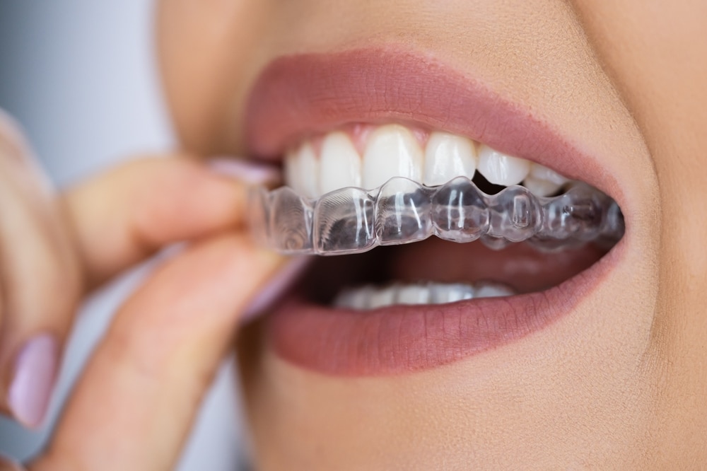 Suresmile Grand Rapids. Dr. Nithya Baker. Baker Dental Studio. General Dentist, Cosmetic Dentist, Restorative Dentist, Preventative Dentist, Family Dentist. SureSmile, Family Dentistry(Pediatric Dentistry), teeth Whitening, 3D Scanner. Dental Studio in Grand Rapids, MI 49546