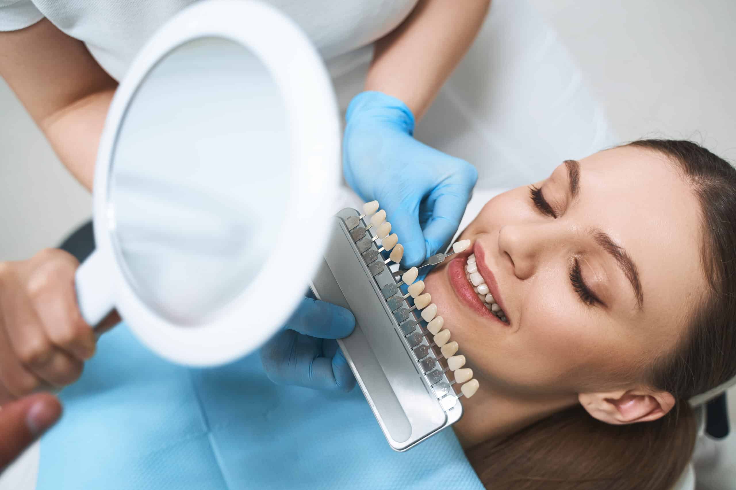 Dental Veneers in Grand Rapids