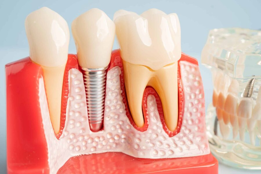 dentures grand rapids