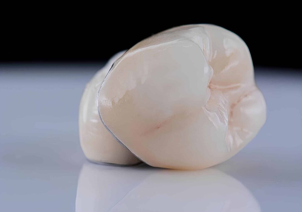dental crowns grand rapids